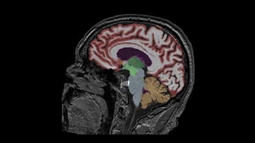 mr neuroquant